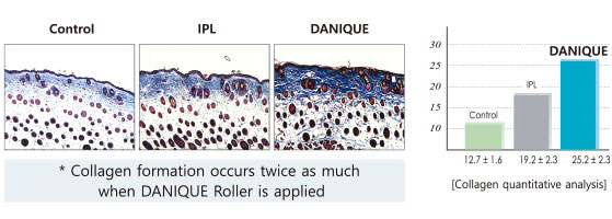 Wound Healing Process
