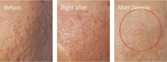 Before & After Pictures