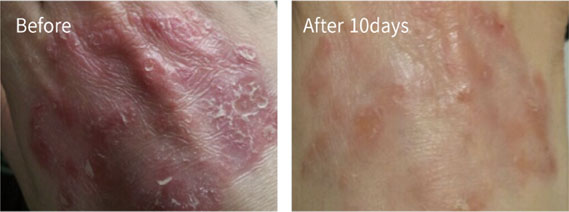 Before & After Pictures